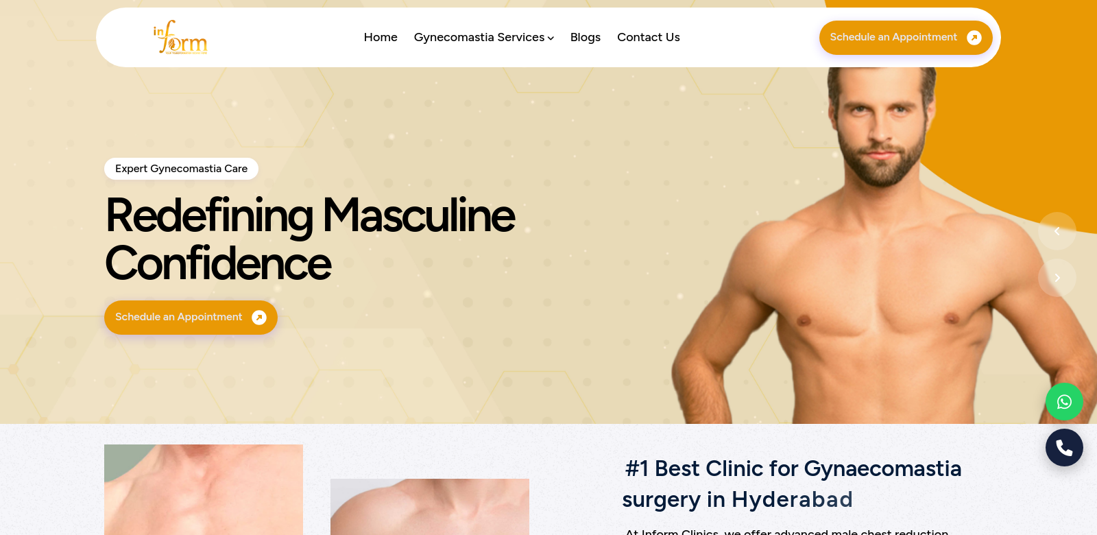 Best Gynaecomastia Surgeon in Hyderabad screenshot