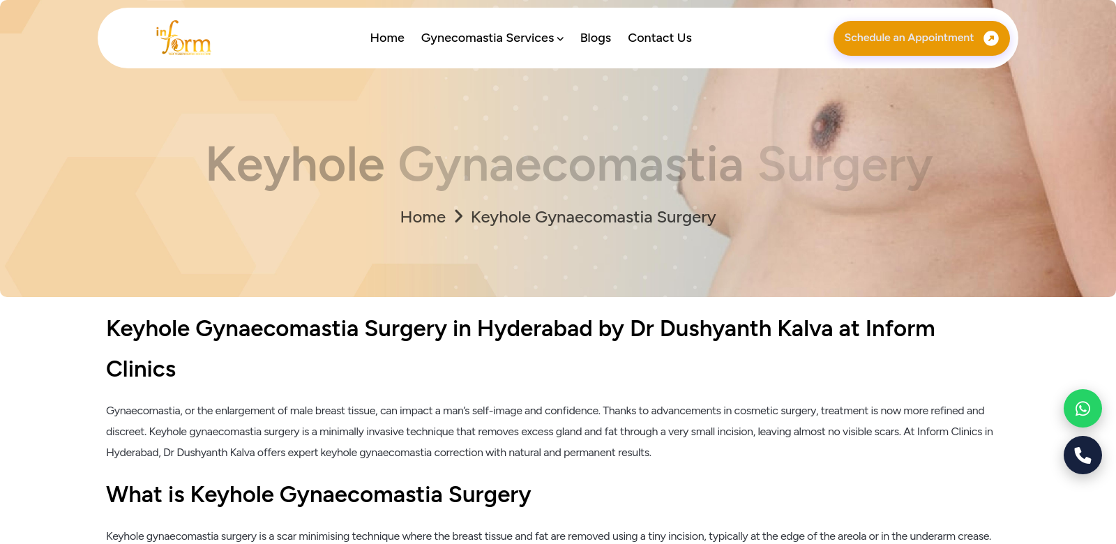 keyhole male breast reduction in Hyderabad screenshot