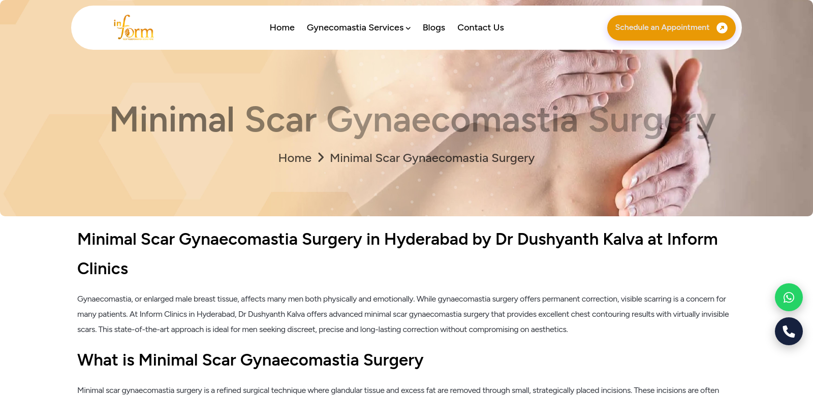 minimal scar gynaecomastia surgery cost in Hyderabad screenshot