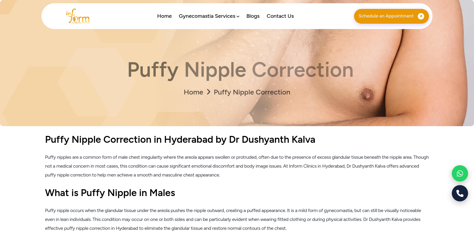 puffy nipple correction cost in Hyderabad screenshot